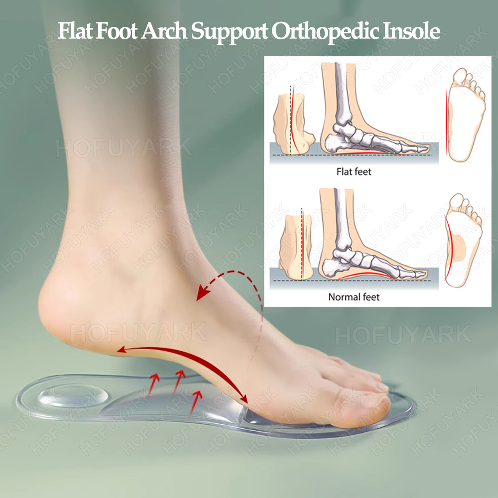 Silicone Gel Insoles Orthopedi - Women'S Shoes High Arch Support บทวิจารณ์และราคา